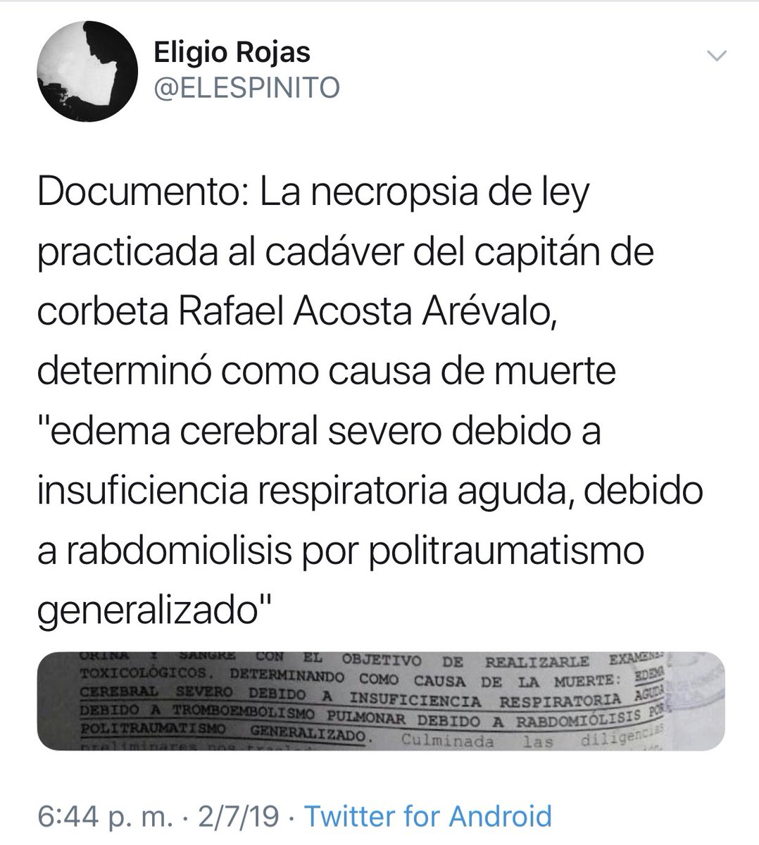 Dieron A Conocer Autopsia Del Capitán De Corbeta Rafael Acosta Arévalo